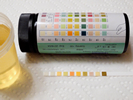 Bladder Cancer Test Strips