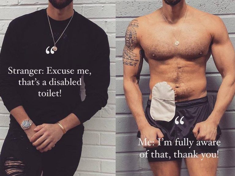 StomaGuy Bladder Cancer Australia