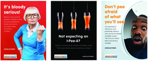Free Bladder Cancer Awareness Posters
